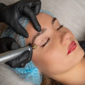 A Lady getting Fibroblast Plasma Lift | La Vida Laser & Aesthetics Institute in Houston, TX