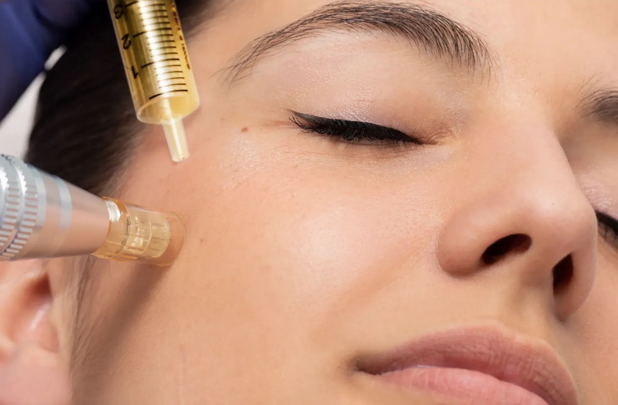 Microagujas-Especialista-en-Induccion-de-Colageno-Lavida-aesthetic-institute-lavidaai-Houston-TX.jpg